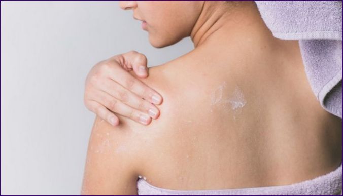 7 vonkajších príčin šupinatej kože na tele