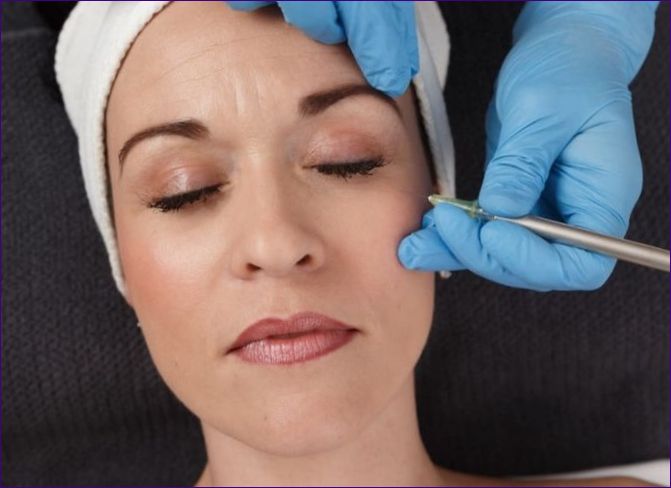 Karboxyterapia tváre: čo je to kozmetika, ako sa neinvazívny postup vykonáva
